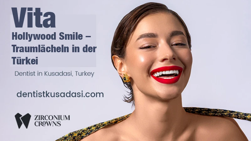 Bestes Zahnarztangebot – Vita Hollywood Smile