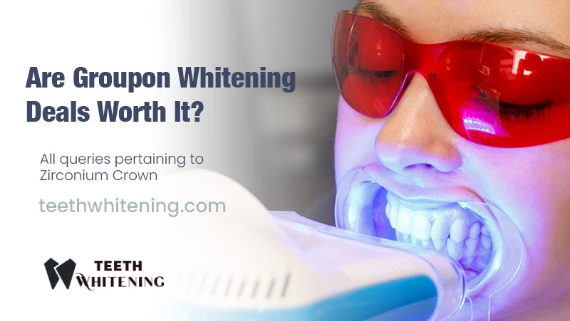 Are Groupon Whitening Deals Worth It?