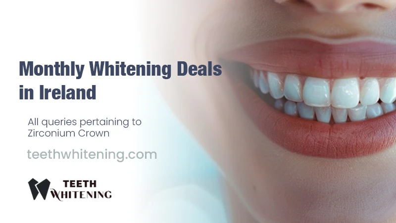 Monthly Whitening Deals in Ireland