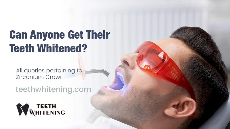 Can Anyone Get Their Teeth Whitened?