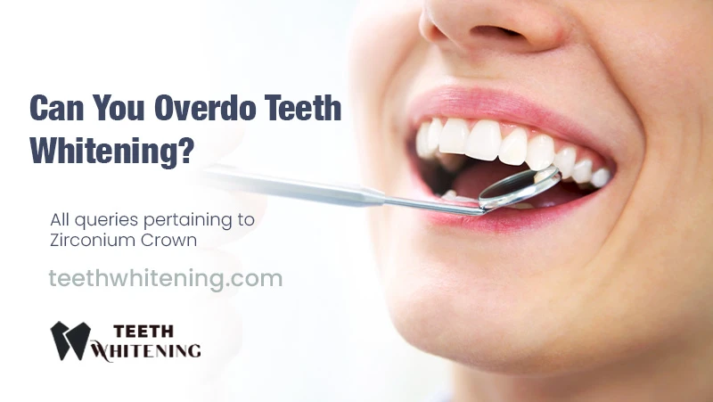 Can You Overdo Teeth Whitening?