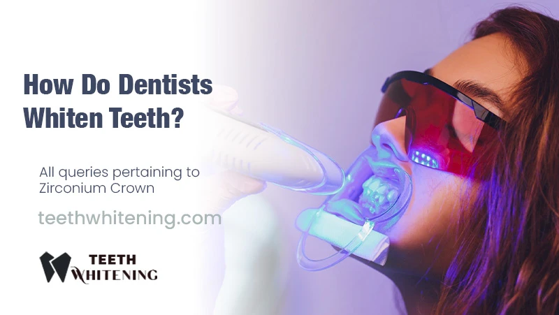 How Do Dentists Whiten Teeth?