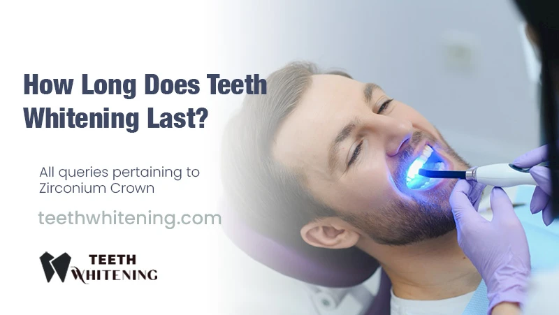 How Long Does Teeth Whitening Last?
