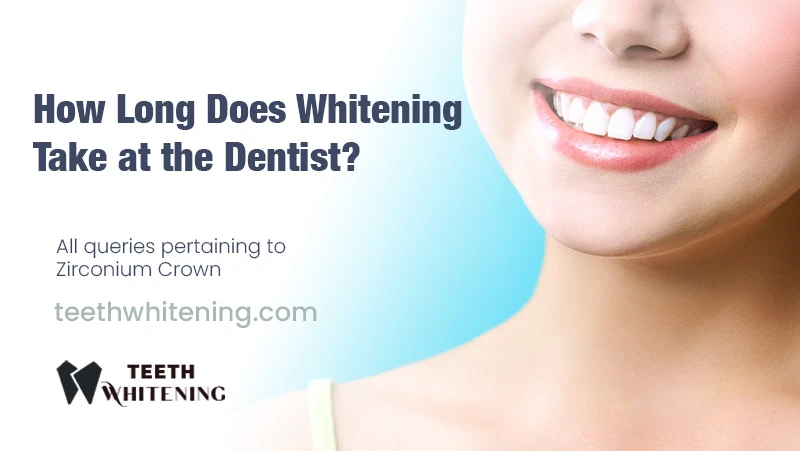 How Long Does Whitening Take at the Dentist?
