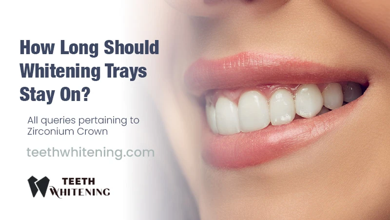 How Long Should Whitening Trays Stay On?