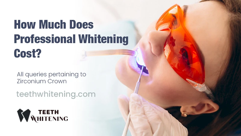 How Much Does Professional Whitening Cost?