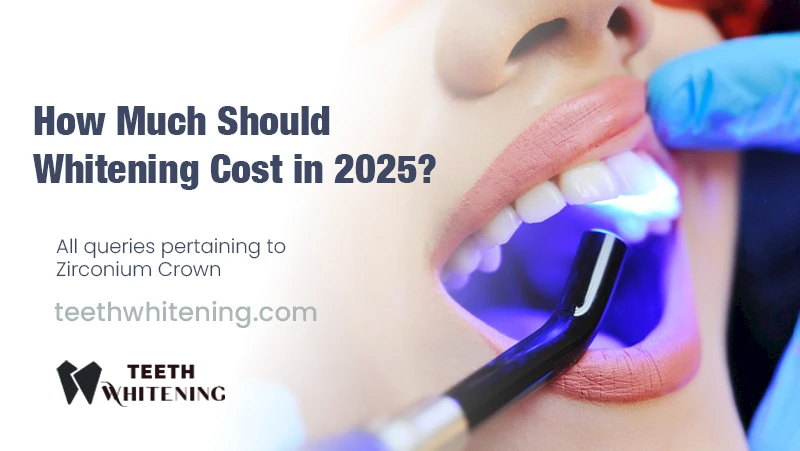 How Much Should Whitening Cost in 2025?
