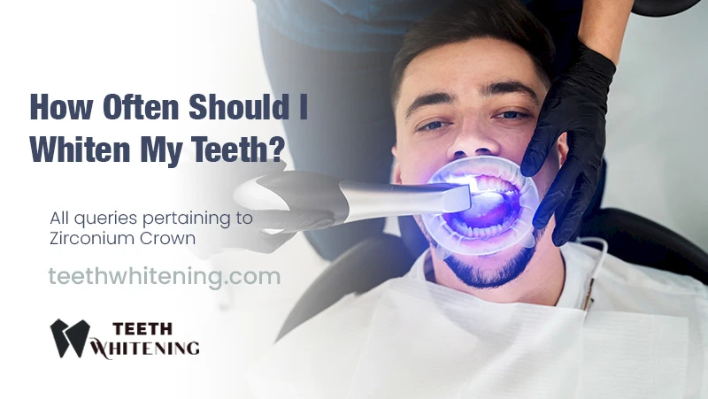 How Often Should I Whiten My Teeth?