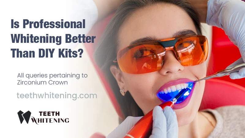 Is Professional Whitening Better Than DIY Kits?