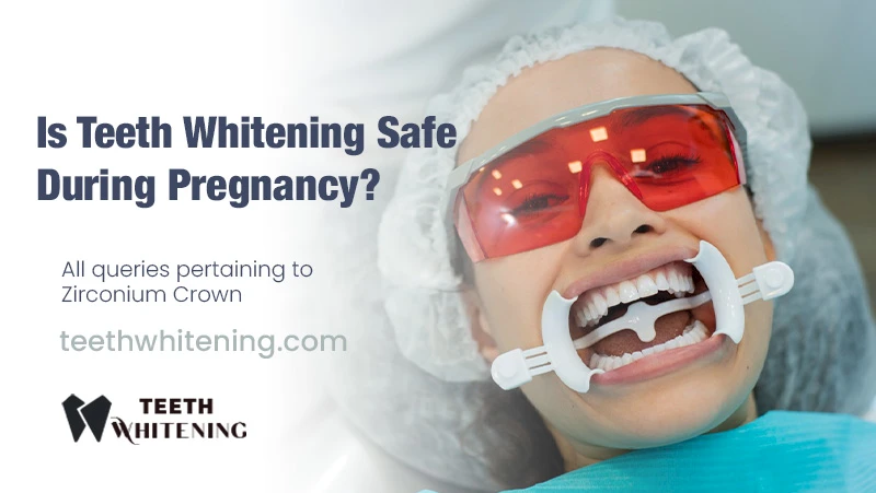 Is Teeth Whitening Safe During Pregnancy?