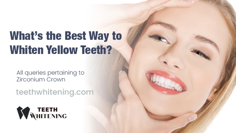 What’s the Best Way to Whiten Yellow Teeth?