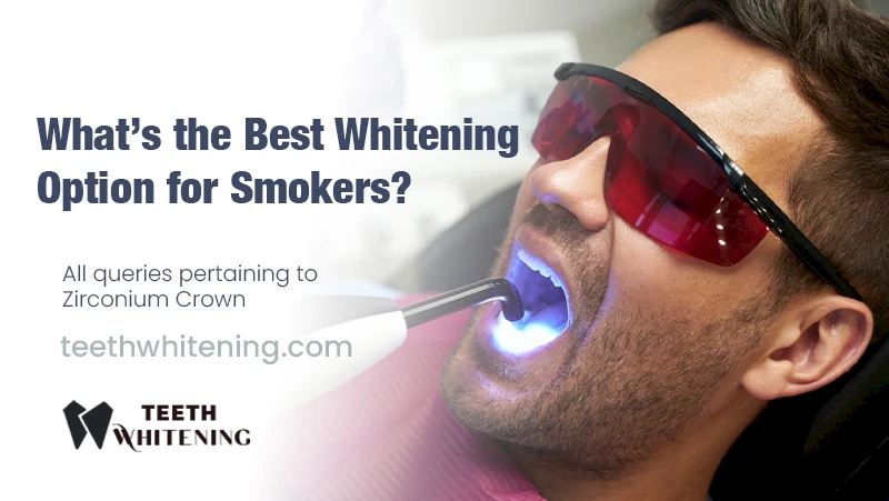 What’s the Best Whitening Option for Smokers?