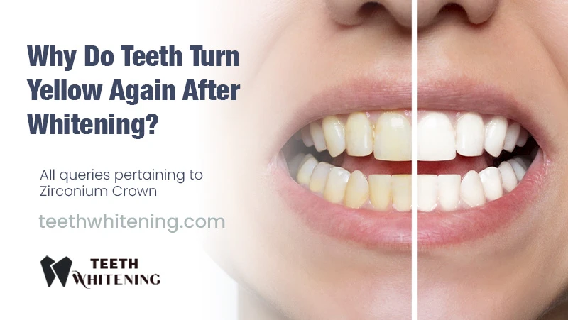 Why Do Teeth Turn Yellow Again After Whitening?