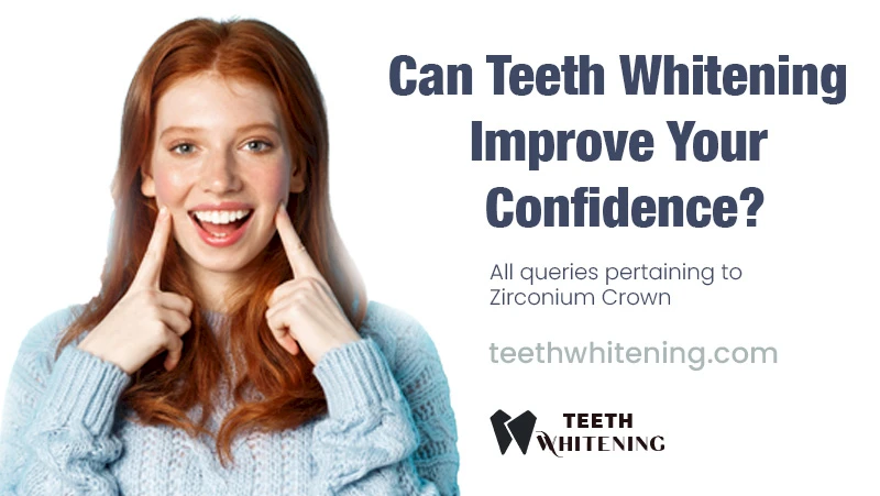 Can Teeth Whitening Improve Your Confidence?