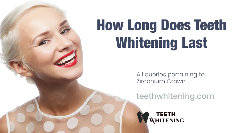 How Long Does Teeth Whitening Last?