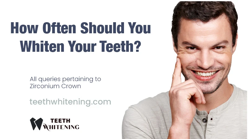 How Often Should You Whiten Your Teeth?