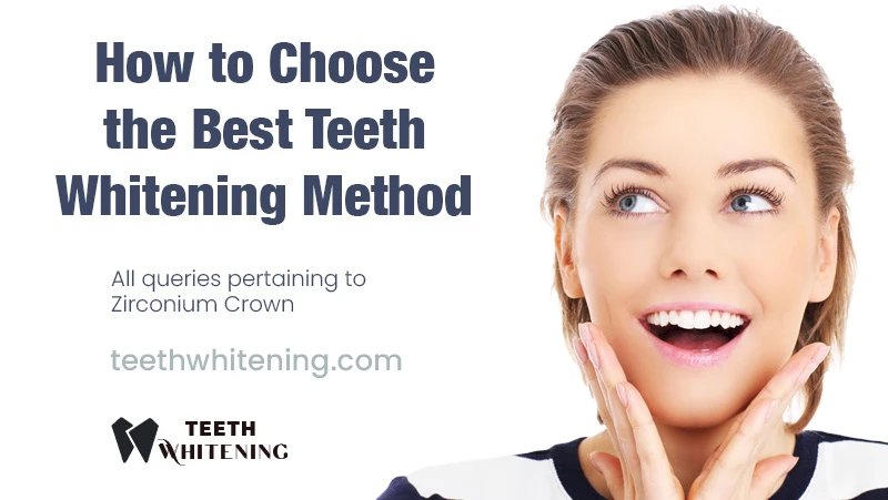 How to Choose the Best Teeth Whitening Method