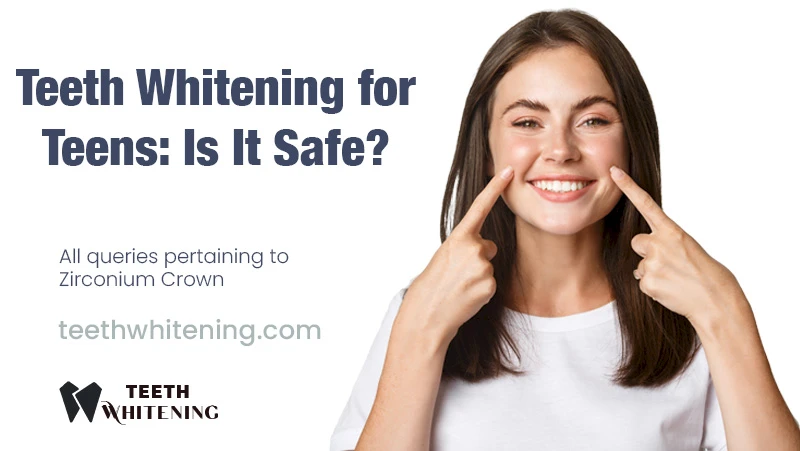 Teeth Whitening for Teens: Is It Safe?