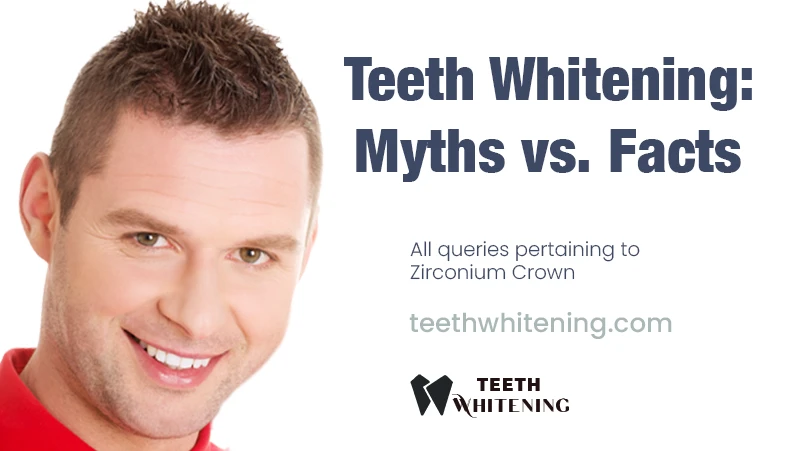 Teeth Whitening: Myths vs. Facts