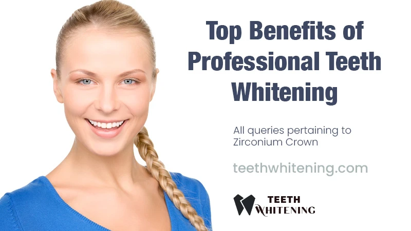 Top Benefits of Professional Teeth Whitening