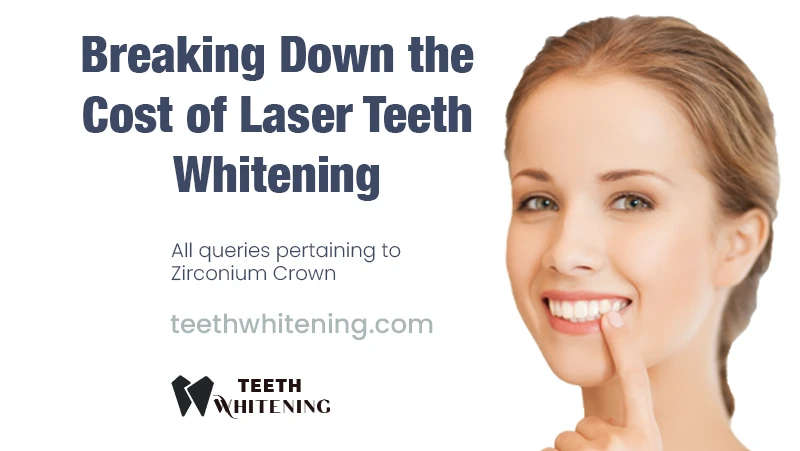 Breaking Down the Cost of Laser Teeth Whitening
