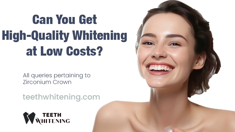 Can You Get High-Quality Whitening at Low Costs?