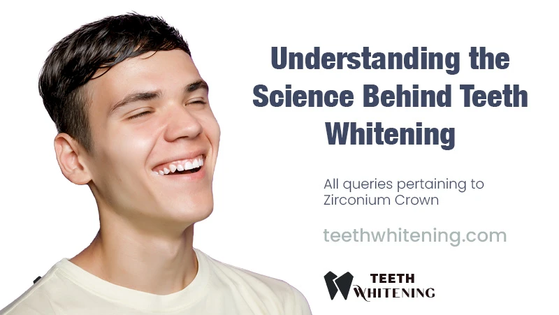 Understanding the Science Behind Teeth Whitening