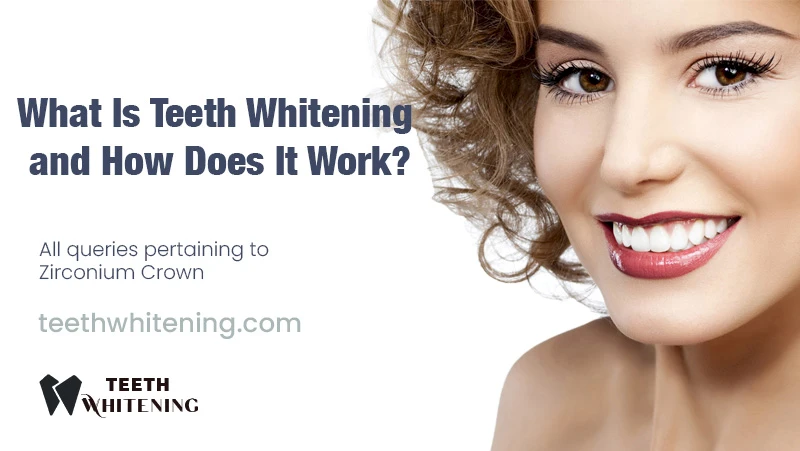 What Is Teeth Whitening and How Does It Work?
