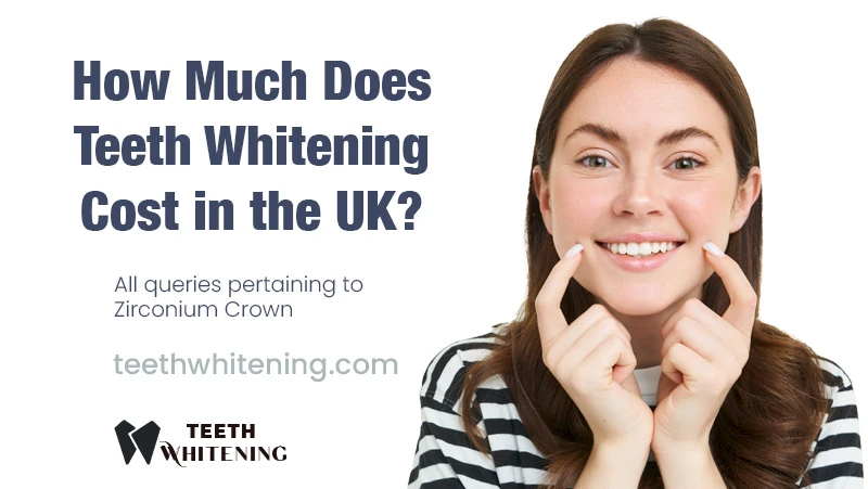 Wie viel kostet Zahnaufhellung im Vereinigten Königreich?