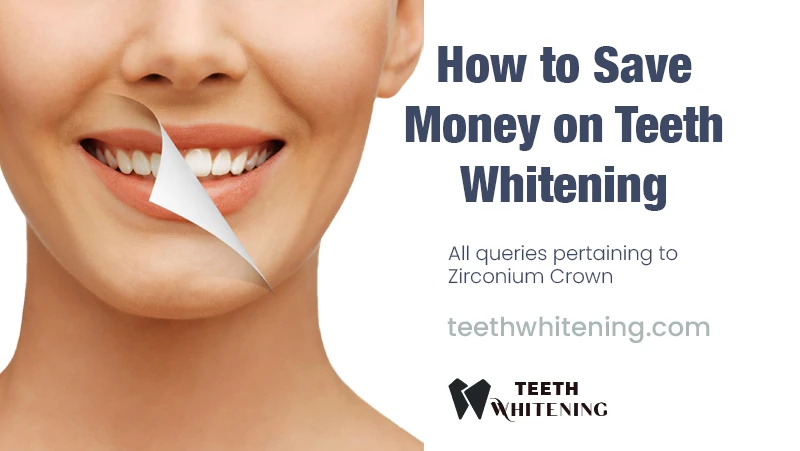 How to Save Money on Teeth Whitening