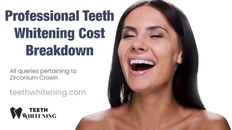 Professional Teeth Whitening Cost Breakdown