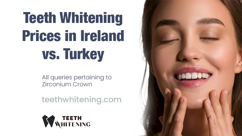 Teeth Whitening Prices in Ireland vs. Turkey