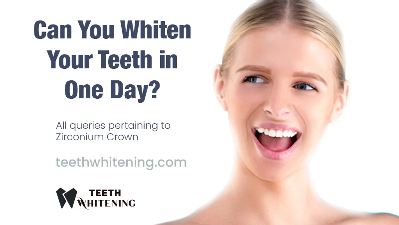 Can You Whiten Your Teeth in One Day?