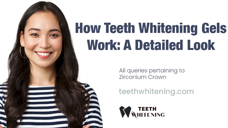 How Teeth Whitening Gels Work: A Detailed Look
