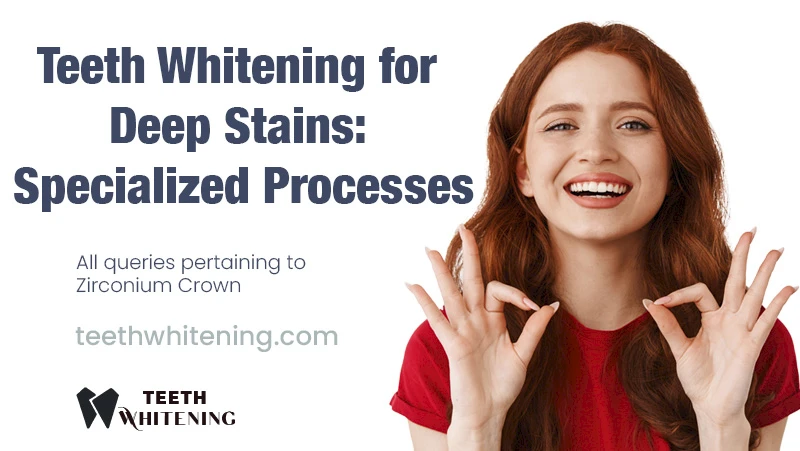 Teeth Whitening for Deep Stains: Specialized Processes