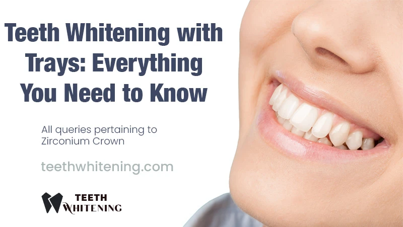 Teeth Whitening with Trays: Everything You Need to Know