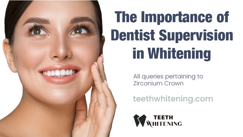 The Importance of Dentist Supervision in Whitening
