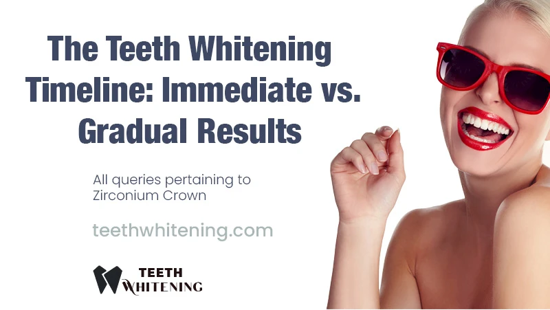 The Teeth Whitening Timeline: Immediate vs. Gradual Results