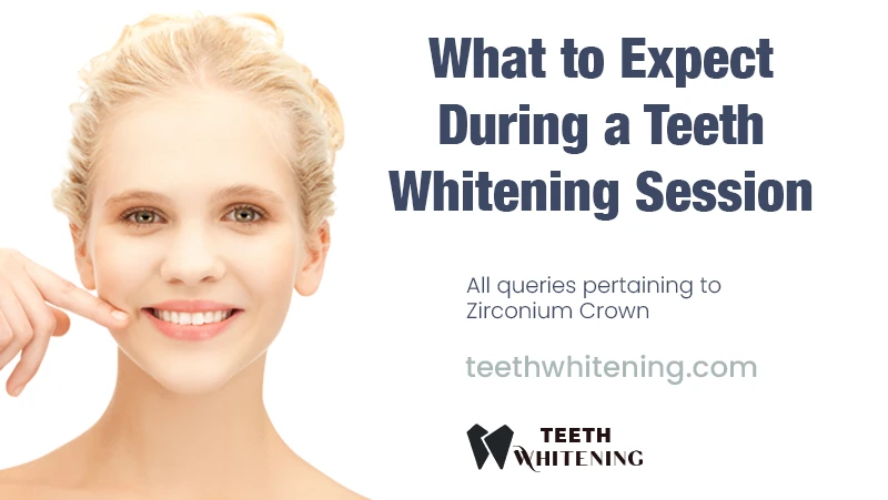 What to Expect During a Teeth Whitening Session