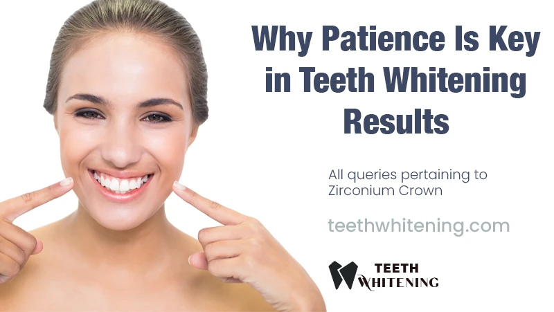 Why Patience Is Key in Teeth Whitening Results